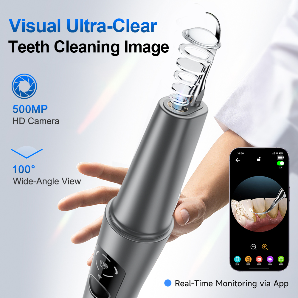 Nuovo Ablatore Dentale a Ultra - Photography Lighting Gear recensione e prezzo